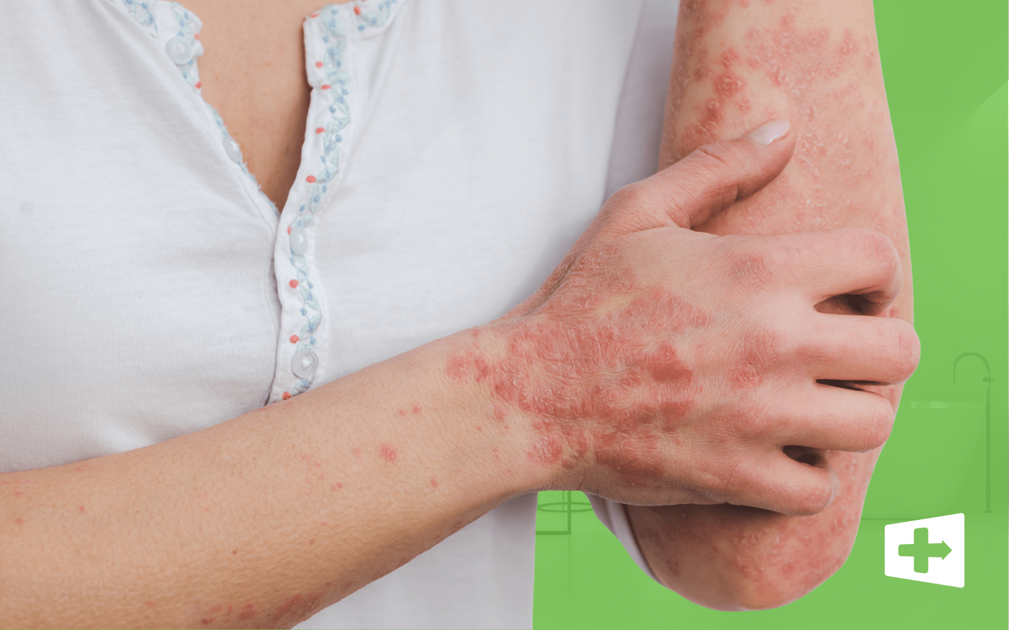 Psoriasis Is More Than Dry Skin: 7 Things Your Dermatologist Wants You to Know